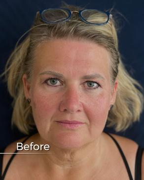 Slider image (2) Boroyan Plastic Surgery in Yerevan Armenia